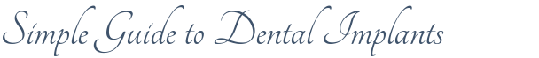 Dentist Walnut Creek Simple Guide to Dental Implants